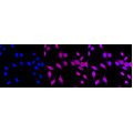 KD-Validated MMUT Rabbit mAb (20 μl)