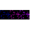 KD-Validated MMUT Rabbit mAb (20 μl)