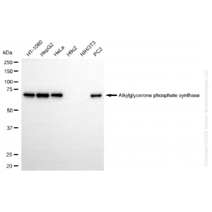 KD-Validated AGPS Rabbit mAb (20 μl)