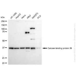 KD-Validated CAB39 Rabbit mAb (20 μl)