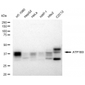 KD-Validated ATP1B3 Rabbit mAb (20 μl)