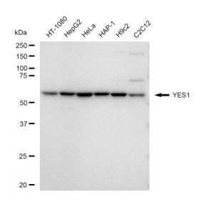 KD-Validated YES1 Rabbit mAb (20 μl)