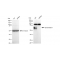 KD-Validated BACE1 Rabbit mAb (20 μl)