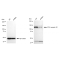 KD-Validated EPHB1 Rabbit mAb (20 μl)