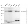 KD-Validated GOLGA2 Rabbit mAb (20 μl)