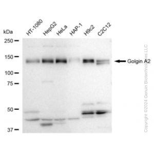 KD-Validated GOLGA2 Rabbit mAb (20 μl)