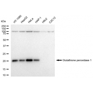 KD-Validated GPX1 Rabbit mAb (20 μl)