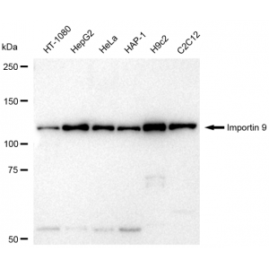 KD-Validated IPO9 Rabbit mAb (20 μl)