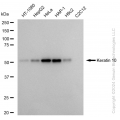 KD-Validated KRT10 Rabbit mAb (20 μl)