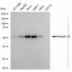 KD-Validated KRT10 Rabbit mAb (20 μl)