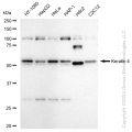 KD-Validated KRT4 Rabbit mAb (20 μl)