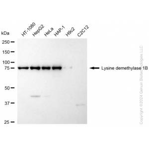 KD-Validated KDM1B Rabbit mAb (20 μl)