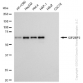 KD-Validated IGF2BP3 Rabbit mAb (20 μl)