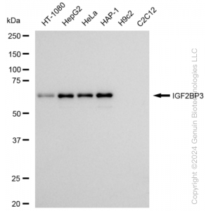 KD-Validated IGF2BP3 Rabbit mAb (20 μl)