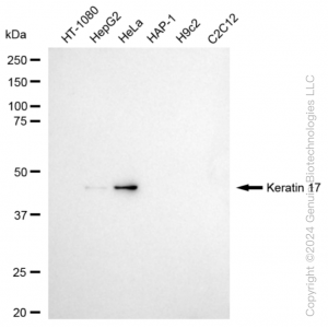KD-Validated KRT17 Rabbit mAb (20 μl)