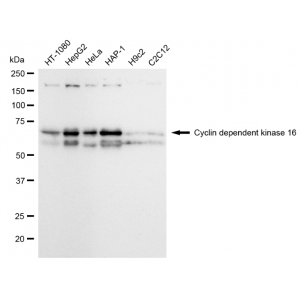 KD-Validated CDK16 Rabbit mAb (20 μl)