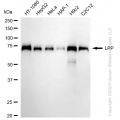 KD-Validated LPP Rabbit mAb (20 μl)