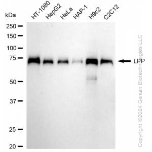 KD-Validated LPP Rabbit mAb (20 μl)