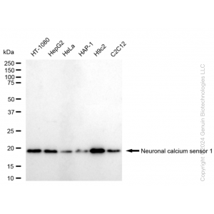 KD-Validated NCS1 Rabbit mAb (20 μl)