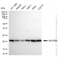 KD-Validated NDUFB9 Rabbit mAb (20 μl)