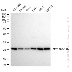 KD-Validated NDUFB9 Rabbit mAb (20 μl)