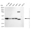 KD-Validated MVK Rabbit mAb (20 μl)