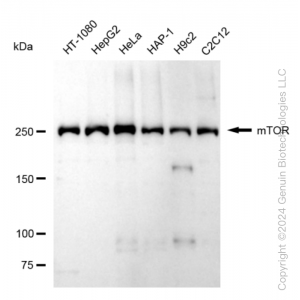 KD-Validated MTOR Rabbit mAb (20 μl)