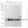 KD-Validated MSI2 Rabbit mAb (20 μl)