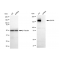 KD-Validated EGFR Rabbit mAb (20 μl)