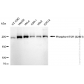 KD-Validated Phospho-mTOR (S2481) Rabbit mAb (20 μl)