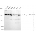 KD-Validated Phospho-mTOR (S2448) Rabbit mAb (20 μl)