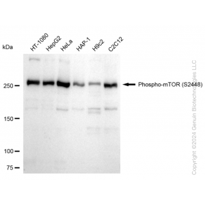 KD-Validated Phospho-mTOR (S2448) Rabbit mAb (20 μl)