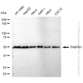 KD-Validated PABPN1 Rabbit mAb (20 μl)