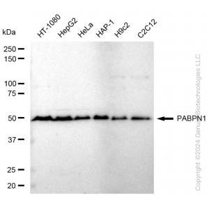 KD-Validated PABPN1 Rabbit mAb (20 μl)