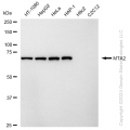 KD-Validated MTA2 Rabbit mAb (20 μl)