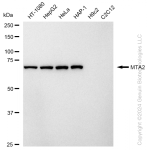 KD-Validated MTA2 Rabbit mAb (20 μl)