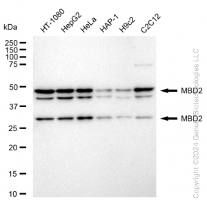 KD-Validated MBD2 Rabbit mAb (20 μl)