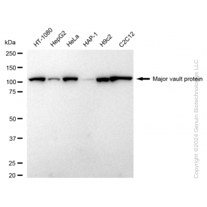 KD-Validated MVP Rabbit mAb (20 μl)