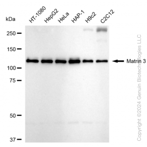 KD-Validated MATR3 Rabbit mAb (20 μl)