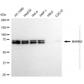KD-Validated MARK2 Rabbit mAb (20 μl)