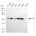 KD-Validated LYN Proto-Oncogene Rabbit mAb (20 μl)