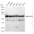 KD-Validated NR2C2 Rabbit mAb (20 μl)