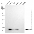 KD-Validated PCBD1 Rabbit mAb (20 μl)