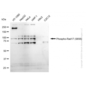 KD-Validated Phospho-Rad17 (S656) Rabbit mAb (20 μl)