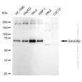 KD-Validated RAVER2 Rabbit mAb (20 μl)