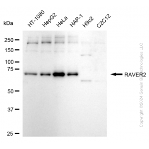 KD-Validated RAVER2 Rabbit mAb (20 μl)