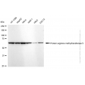 KD-Validated PRMT5 Rabbit mAb (20 μl)