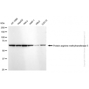 KD-Validated PRMT5 Rabbit mAb (20 μl)