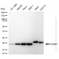 KD-Validated PBP Rabbit mAb (20 μl)