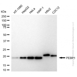 KD-Validated PBP Rabbit mAb (20 μl)